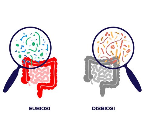 Eubiosi vs Disbiosi