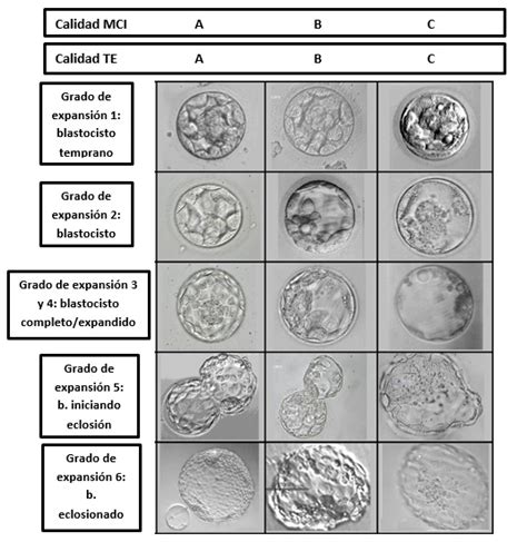Sistema di classificazione Gardner per blastocisti
