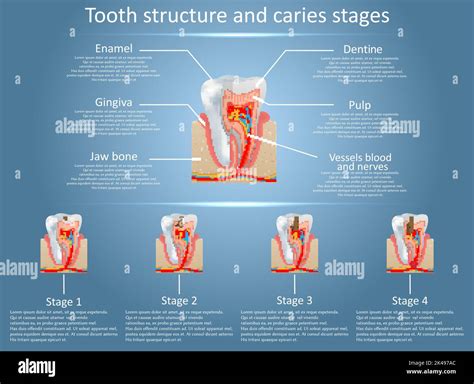 illustrazione schematica dello sviluppo dentale nel neonato
