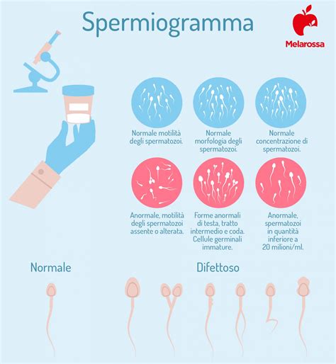 Grafico dei risultati di uno spermiogramma