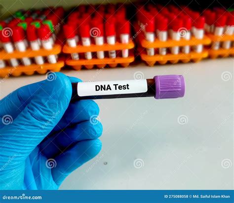 DNA strands in blood sample