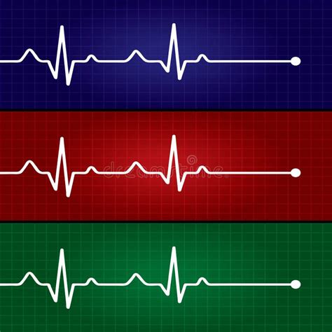 grafico che mostra l'andamento dei battiti cardiaci fetali nel tempo