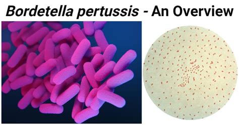 rappresentazione microscopica di Bordetella pertussis