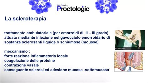 schema del trattamento chirurgico mediante laser-coagulazione fetoscopica