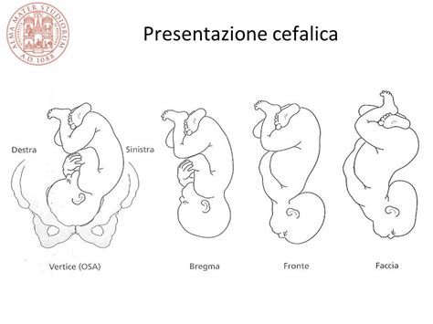 Diagramma della posizione cefalica anteriore (occipite anteriore)