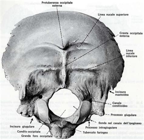 Diagramma della posizione cefalica posteriore (occipite posteriore)