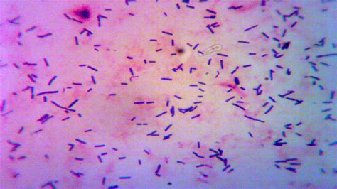 Lactobacillus reuteri al microscopio