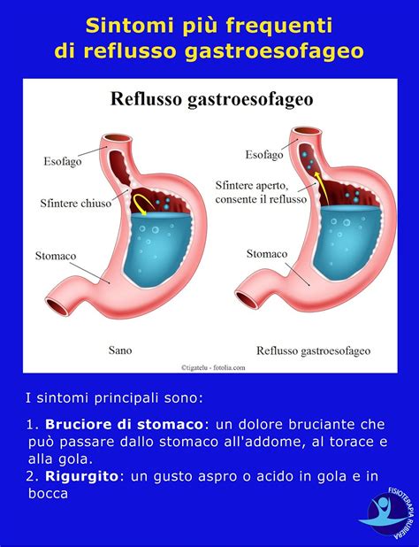 Meccanismi di coliche e reflusso