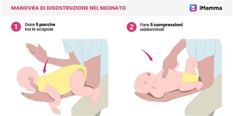 Manovre di disostruzione neonatale