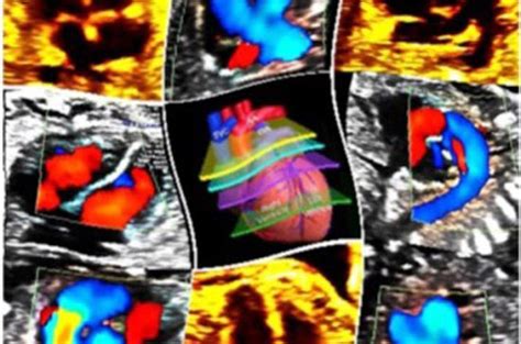 visualizzazione del cuore fetale mediante tecnologia 4D e Doppler
