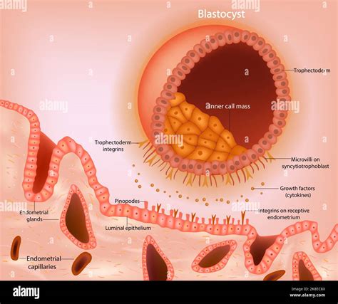 Impianto di blastocisti nella parete uterina