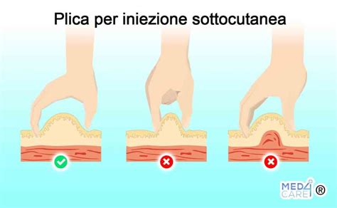illustrazione veterinaria che mostra il posizionamento sottocutaneo dell'impianto di deslorelina