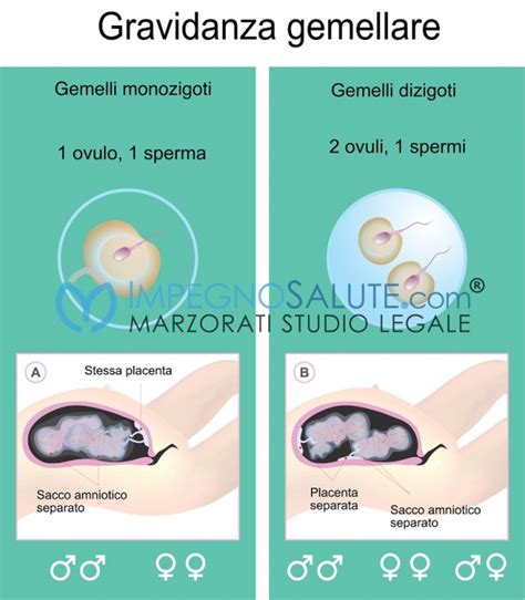 Monitoraggio di gravidanza gemellare