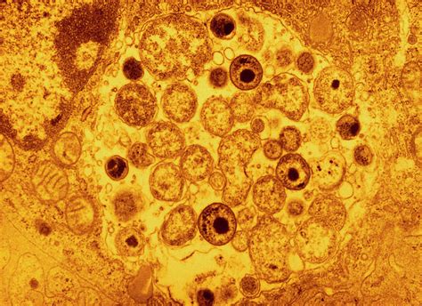 Illustrazione microscopica di Chlamydia psittaci