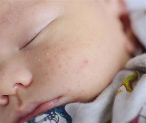 Dettaglio di macchie mongoliche sul neonato
