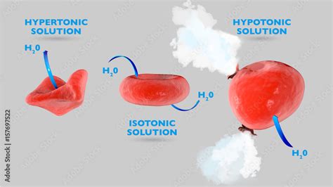 Tabella comparativa: soluzione isotonica vs ipertonica