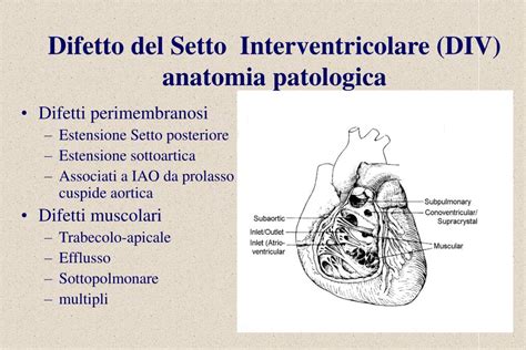 Classificazione dei difetti del setto interventricolare per sede