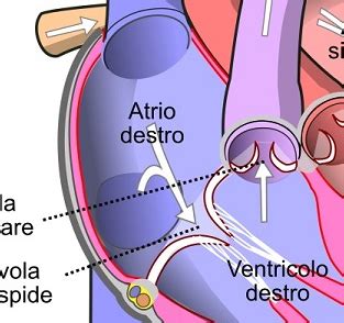 Schema di posizionamento del CVO (vena cava inferiore/atrio destro)
