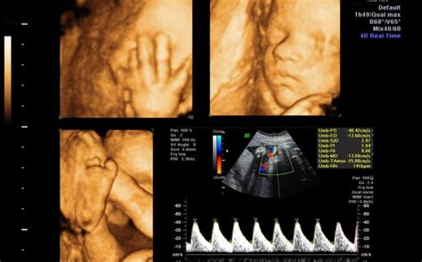 Ecografia morfologica del secondo trimestre dettagli anatomici