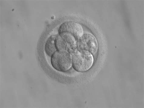 Microscopio che mostra uno stadio precoce di sviluppo embrionale