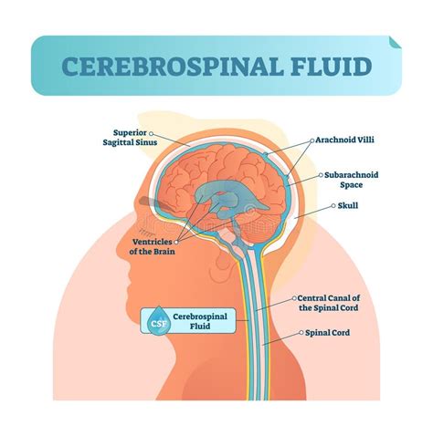 Diagramma che mostra la fuoriuscita di liquido cerebrospinale dalla dura madre dopo una puntura