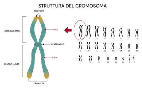 Cromosomi umani e trisomie comuni (21, 18, 13)