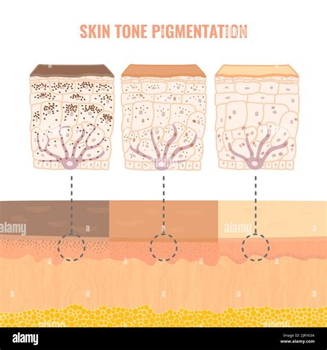Effetti della gravidanza sulla pigmentazione della pelle