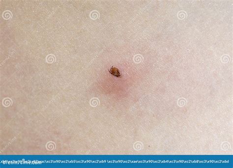 Zecca sulla pelle di tartaruga