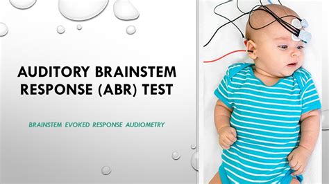 Schema del test ABR con elettrodi e stimoli sonori