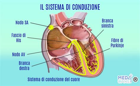 Sistema di conduzione cardiaco