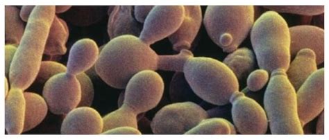 Microscopio che mostra funghi (miceti) responsabili di onicomicosi