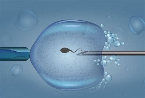 Immagine del processo ICSI: iniezione dello spermatozoo nell'ovocita