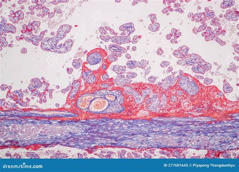 Placenta umana con cordone ombelicale