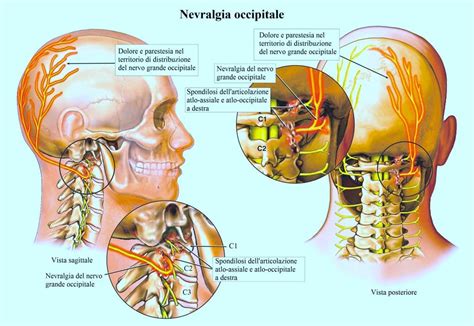 Rappresentazione dell'incompetenza cervicale