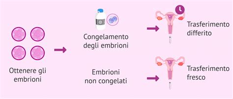 Infografica che illustra i sintomi comuni dopo il trasferimento embrionale