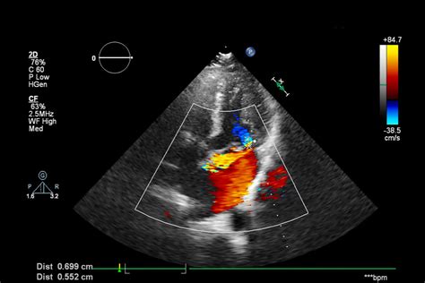 Ecografia Doppler fetale con visualizzazione dei flussi sanguigni