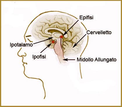 Rappresentazione schematica del craniofaringeoma e la sua posizione rispetto a ipofisi e nervi ottici