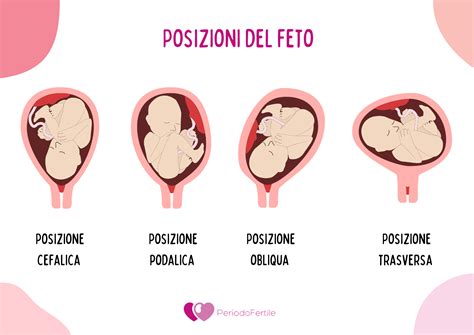 illustrazione del feto in diverse posizioni all'interno dell'utero