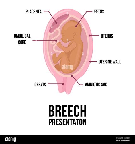 Diagramma del feto in utero con evidenziate aree di interesse per la RM