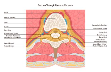 sezione trasversale di una vertebra con spazio epidurale evidenziato
