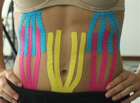 Applicazione del taping kinesiologico in gravidanza
