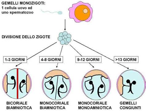 Tipi di gravidanza gemellare (monozigote vs dizigote con varianti di corionicità e amnionicità)