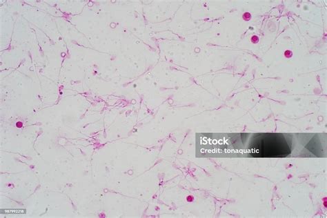 Microscopio che mostra spermatozoi