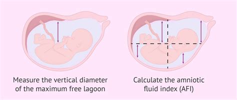 Misurazione Indice Liquido Amniotico (AFI)