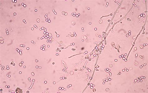 Immagine microscopica di Candida albicans