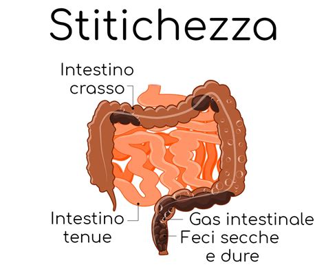 Differenza tra stitichezza e dischezia