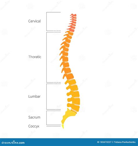 Sezione della colonna vertebrale con ematoma epidurale