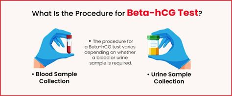 Schema comparativo test urine vs test sangue Beta HCG