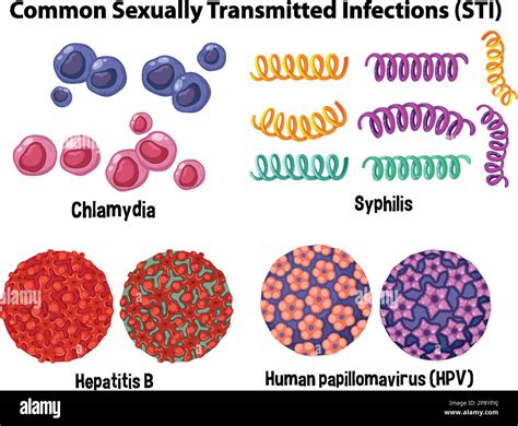 infografica sulle infezioni sessualmente trasmissibili e il loro impatto sulla fertilità
