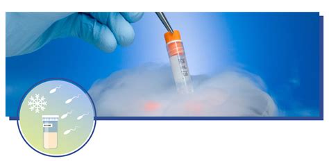 Crioconservazione di ovuli e spermatozoi in azoto liquido